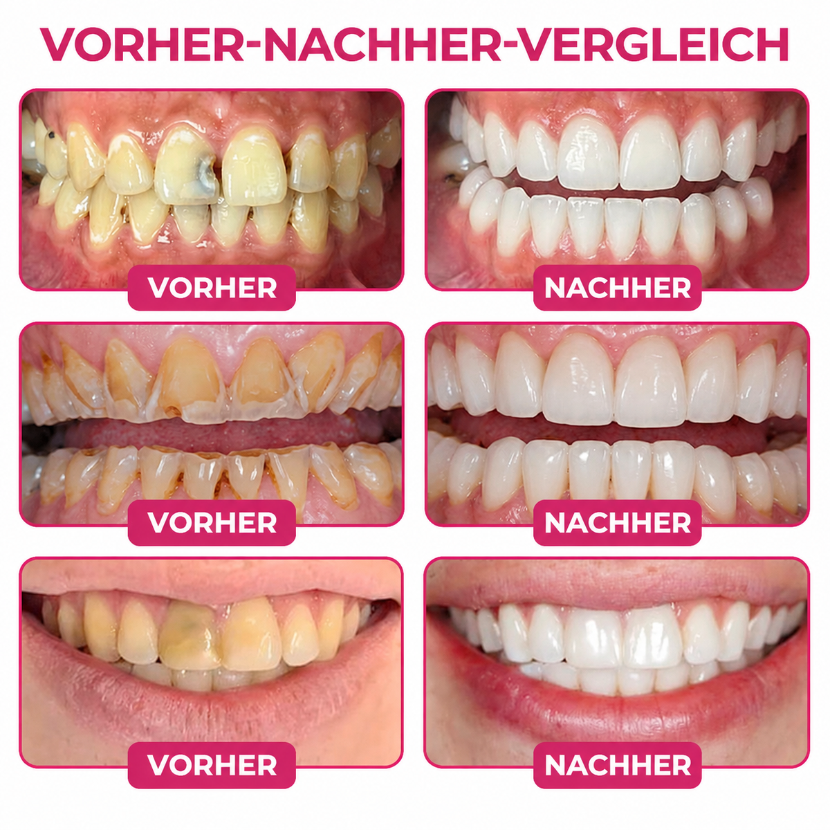✨ 30 % Rabatt auf den zweiten Artikel  | Healrize®🎀