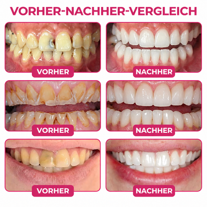 ✨ 30 % Rabatt auf den zweiten Artikel  | Healrize®🎀