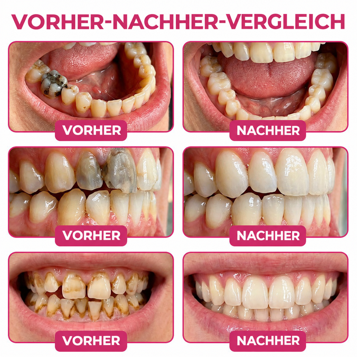 ✨ 30 % Rabatt auf den zweiten Artikel  | Healrize®🎀