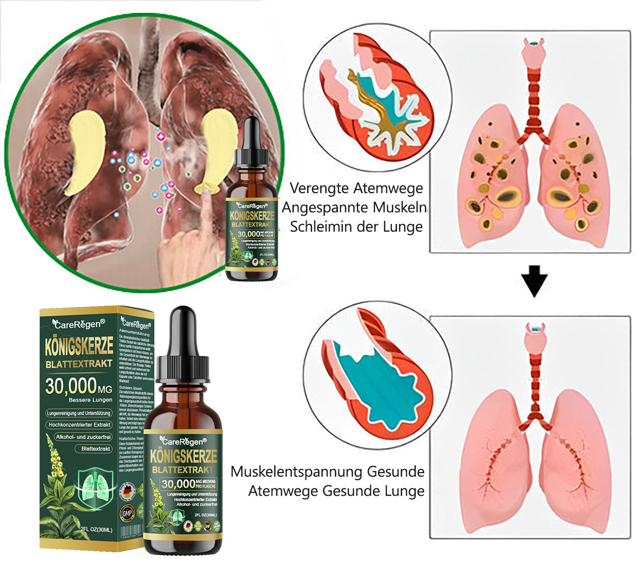 𝗢𝗳𝗳𝗶𝘇𝗶𝗲𝗹𝗹 | CareRegen®🌹💧𝗕𝗶𝗼-𝗟𝘂𝗻𝗴𝗲𝗻𝗿𝗲𝗶𝗻𝗶𝗴𝘂𝗻𝗴𝘀-𝗧𝗿𝗼𝗽𝗳𝗲𝗻 𝗮𝘂𝘀 𝗞𝗼̈𝗻𝗶𝗴𝘀𝗸𝗲𝗿𝘇𝗲𝗻𝗯𝗹𝗮𝘁𝘁-𝗘𝘅𝘁𝗿𝗮𝗸𝘁 𝐊𝐥𝐢𝐧𝐢𝐬𝐜𝐡 𝐛𝐞𝐬𝐭𝐚̈𝐭𝐢𝐠𝐭 – 𝐡𝐨𝐜𝐡𝐤𝐨𝐧𝐳𝐞𝐧𝐭𝐫𝐢𝐞𝐫𝐭𝐞 𝐅𝐨𝐫𝐦𝐞𝐥 𝐳𝐮𝐫 𝐋𝐢𝐧𝐝𝐞𝐫𝐮𝐧𝐠 𝐯𝐨𝐧 𝐇𝐮𝐬𝐭𝐞𝐧, 𝐒𝐜𝐡𝐥𝐞𝐢𝐦, 𝐀𝐬𝐭𝐡𝐦𝐚 𝐮𝐧𝐝 𝐂𝐎𝐏𝐃. 𝐅𝐮̈𝐫 𝐟𝐫𝐞𝐢𝐞𝐫𝐞𝐬, 𝐥𝐞𝐢𝐜𝐡𝐭𝐞𝐫𝐞𝐬 𝐀𝐭𝐦𝐞𝐧 – 𝐬𝐩𝐮̈𝐫𝐛𝐚𝐫 𝐬𝐜𝐡𝐧𝐞𝐥𝐥𝐞𝐫𝐞 𝐖𝐢𝐫𝐤𝐮𝐧𝐠. ✨