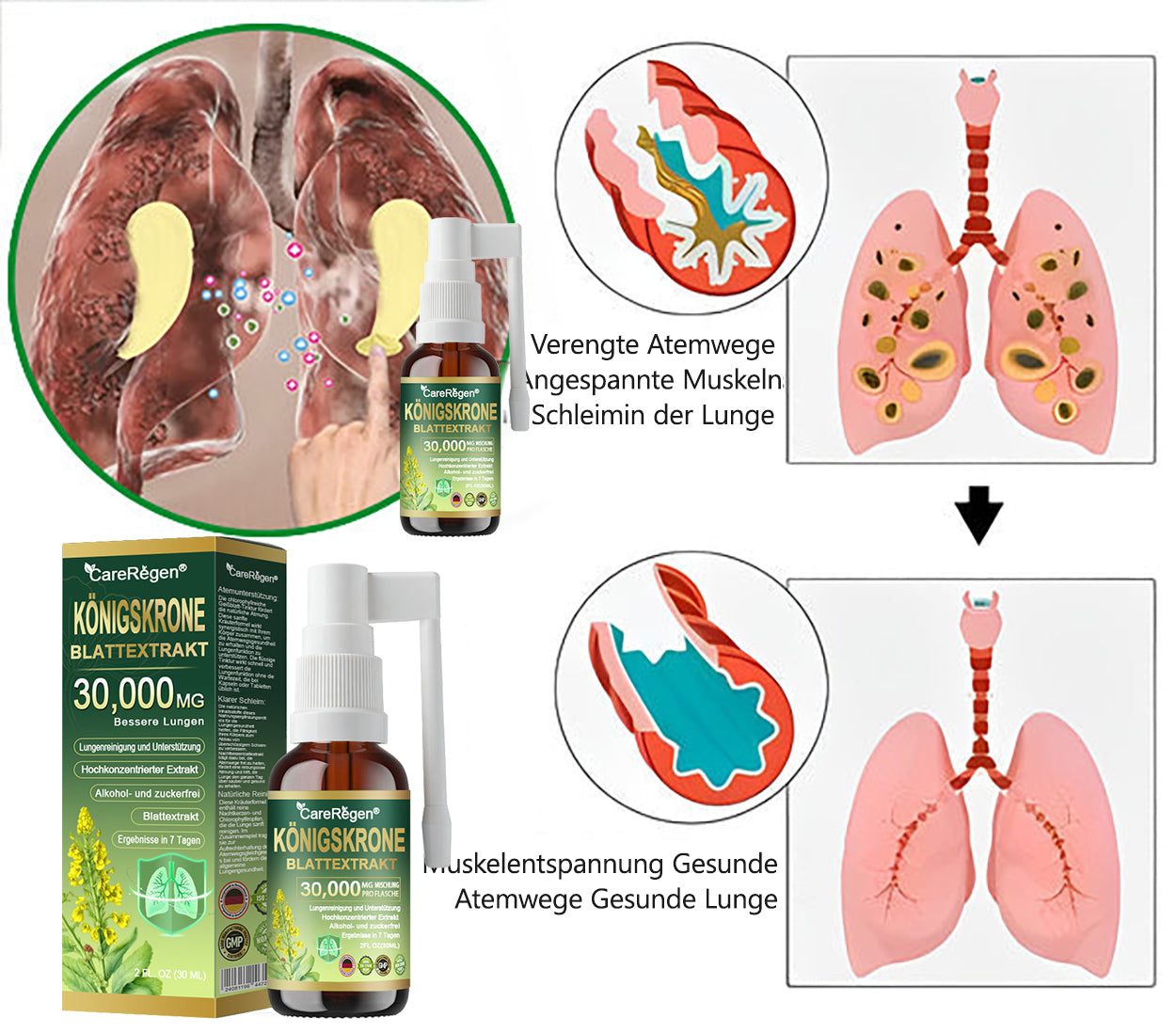 𝗢𝗳𝗳𝗶𝘇𝗶𝗲𝗹𝗹𝗲𝘀 𝗚𝗲𝘀𝗰𝗵ä𝗳𝘁: CareRegen®🪸 𝗕𝗶𝗼𝗹𝗼𝗴𝗶𝘀𝗰𝗵𝗲𝘀 𝗟𝘂𝗻𝗴𝗲𝗻𝗿𝗲𝗶𝗻𝗶𝗴𝘂𝗻𝗴𝘀-𝗜𝗻𝗵𝗮𝗹𝗮𝘁 𝗮𝘂𝘀 𝗞𝗼𝗻𝗶𝗴𝘀𝗸𝗲𝗿𝘇𝗲𝗻𝗯𝗹𝗮𝘁𝘁-𝗘𝘅𝘁𝗿𝗮𝗸𝘁 𝐖𝐢𝐬𝐬𝐞𝐧𝐬𝐜𝐡𝐚𝐟𝐭𝐥𝐢𝐜𝗵 𝐛𝐞𝐰𝐢𝐞𝐬𝐞𝐧𝗲, 𝐡𝗼𝗰𝐡𝐤𝗼𝗻𝐳𝐞𝐧𝐭𝐫𝐢𝐞𝐫𝐭𝐞 𝐅𝐨𝐫𝐦𝐞𝐥, 𝐝𝐢𝐞 𝐇𝐮𝐬𝐭𝐞𝐧, 𝐒𝐜𝐡𝐥𝐞𝐢𝐦, 𝐀𝐬𝐭𝐡𝐦𝐚 𝐮𝐧𝐝 𝐂𝐎𝐏𝐃 𝐥𝗶𝗻𝗱𝐞𝐫𝐭 — 𝐟𝗼𝐫𝐦𝐭 𝐝𝐚𝐬 𝐀𝐭𝐞𝐦𝐞𝐧 𝐞𝐢𝐧𝐟𝐚𝐜𝐡𝐞𝐫 𝐮𝐧𝐝 𝐬𝐜𝐡𝐧𝐞𝐥𝐥𝐞𝐫. 🩵
