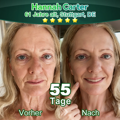 Awzlove® Luxuriöses Anti-Cellulite-Massageöl mit Kollagen und Stammzellen (🔥Nur für kurze Zeit 70 % reduziert!) 🌻🌻