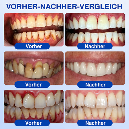🦷 Healrize® GumRevive Gel zur Regeneration des Zahnhalteapparats (bei Zahnfleischbluten, Zahnfleischrückgang und lockeren Zähnen)