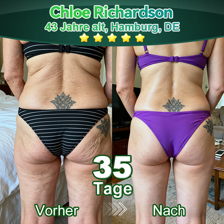 Awzlove® Luxuriöses Anti-Cellulite-Massageöl mit Kollagen und Stammzellen (🔥Nur für kurze Zeit 70 % reduziert!)🩵🩵🩵