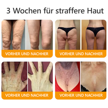 Awzlove® Luxuriöses Kollagen- & Pflanzenstammzellen Anti-Cellulite-Massageöl 🎉 (🔥 Nur für kurze Zeit: 70 % Rabatt!)