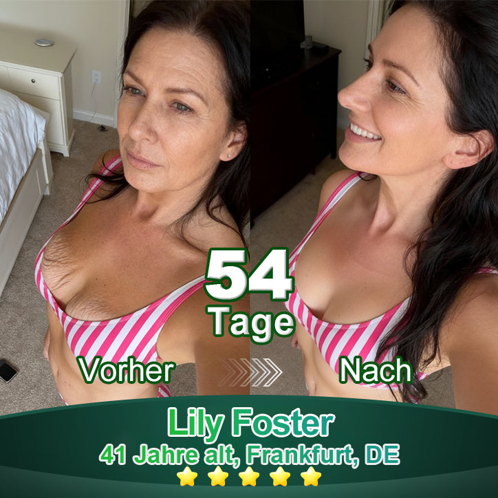 Awzlove® Luxuriöses Anti-Cellulite-Massageöl mit Kollagen und Stammzellen (🔥Nur für kurze Zeit 70 % reduziert!)💜💜💜