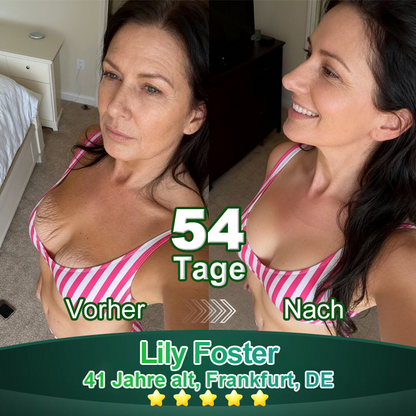 Awzlove® Luxuriöses Anti-Cellulite-Massageöl mit Kollagen und Stammzellen (🔥Nur für kurze Zeit 70 % reduziert!)🩵🩵🩵