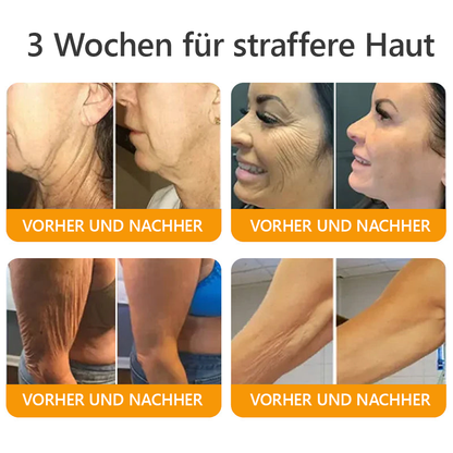 Awzlove® Luxuriöses Kollagen- & Pflanzenstammzellen Anti-Cellulite-Massageöl 🎉 (🔥 Nur für kurze Zeit: 70 % Rabatt!)