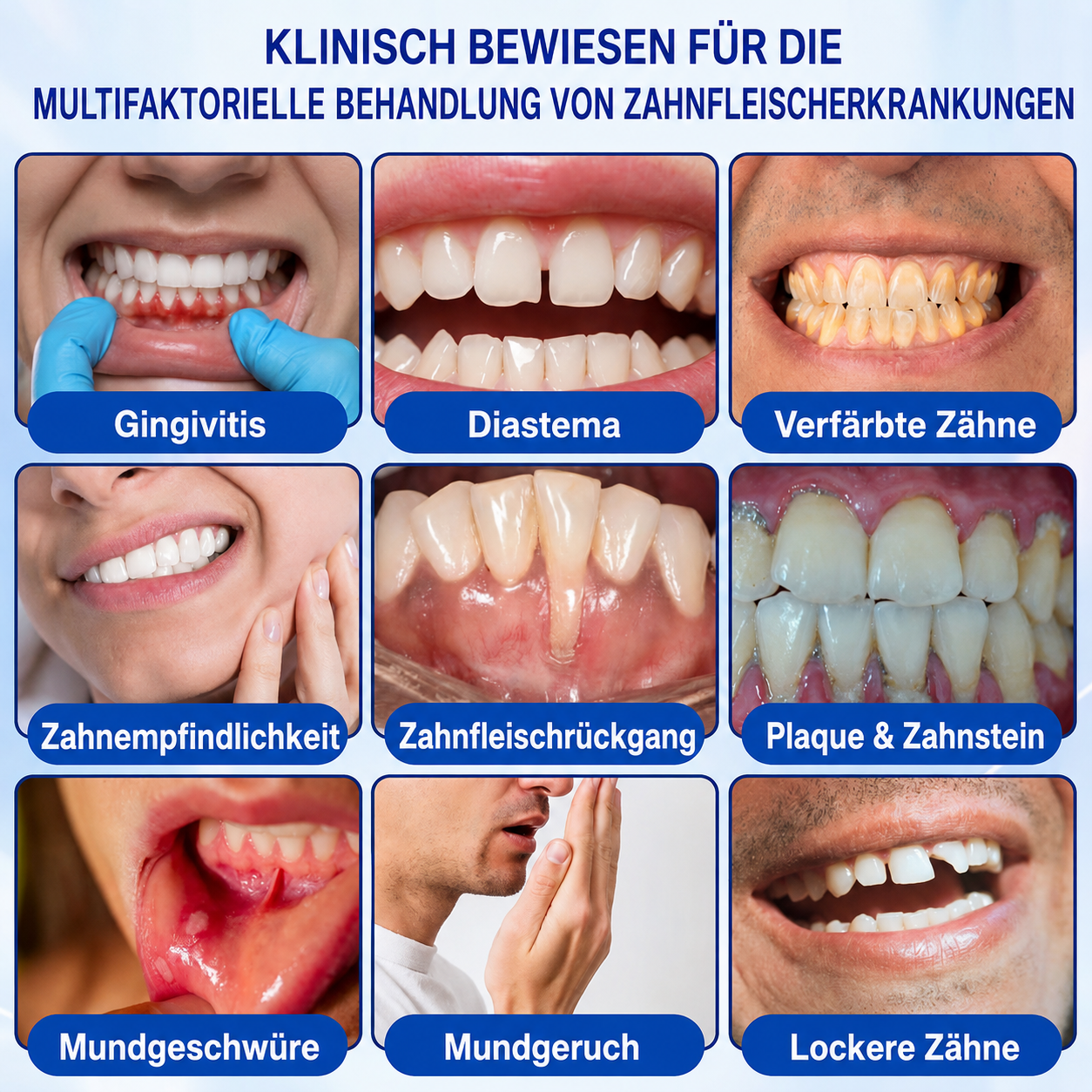 🦷 Healrize® GumRevive Gel zur Regeneration des Zahnhalteapparats (bei Zahnfleischbluten, Zahnfleischrückgang und lockeren Zähnen)