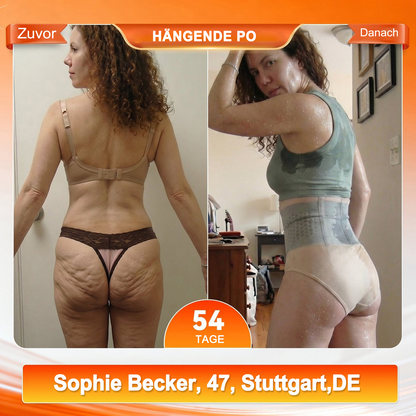 🎇🩳𝐎𝐟𝐟𝐢𝐜𝐢𝐚𝐥 𝐁𝐫𝐚𝐧𝐝 𝐒𝐭𝐨𝐫𝐞 |✅ EXPECTSKY® 2026 Moringa- & Berberin-4-in-1-Shorts zur Körperformung und Fettverbrennung mit Mikropartikeln