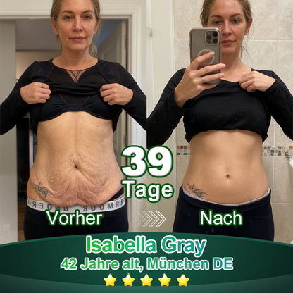 Awzlove® Luxuriöses Anti-Cellulite-Massageöl mit Kollagen und Stammzellen (🔥Nur für kurze Zeit 70 % reduziert!) 🌻🌻