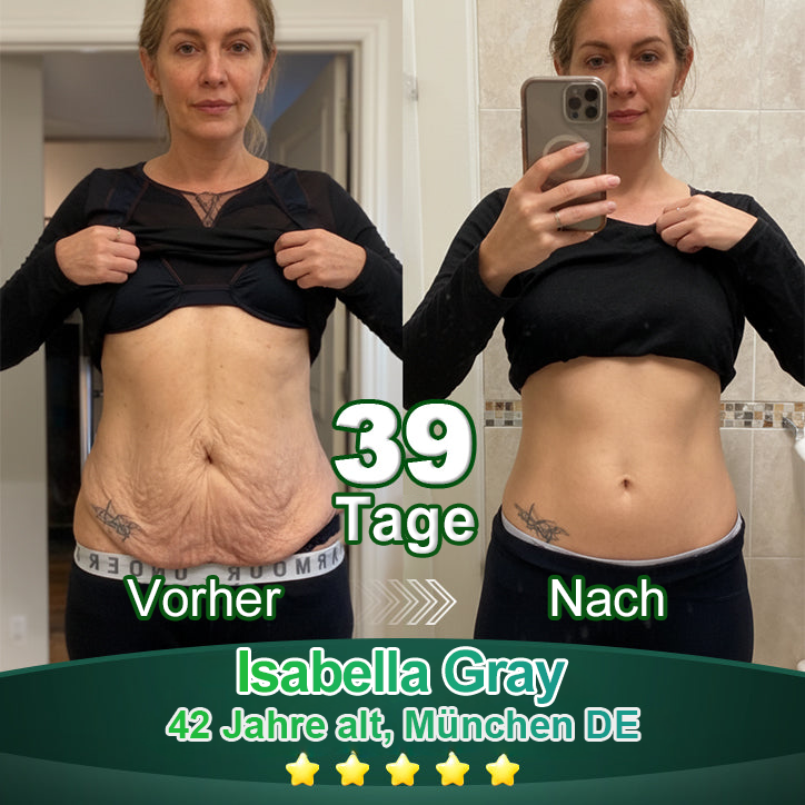 Awzlove® Luxuriöses Anti-Cellulite-Massageöl mit Kollagen und Stammzellen (🔥Nur für kurze Zeit 70 % reduziert!)🩵🩵🩵