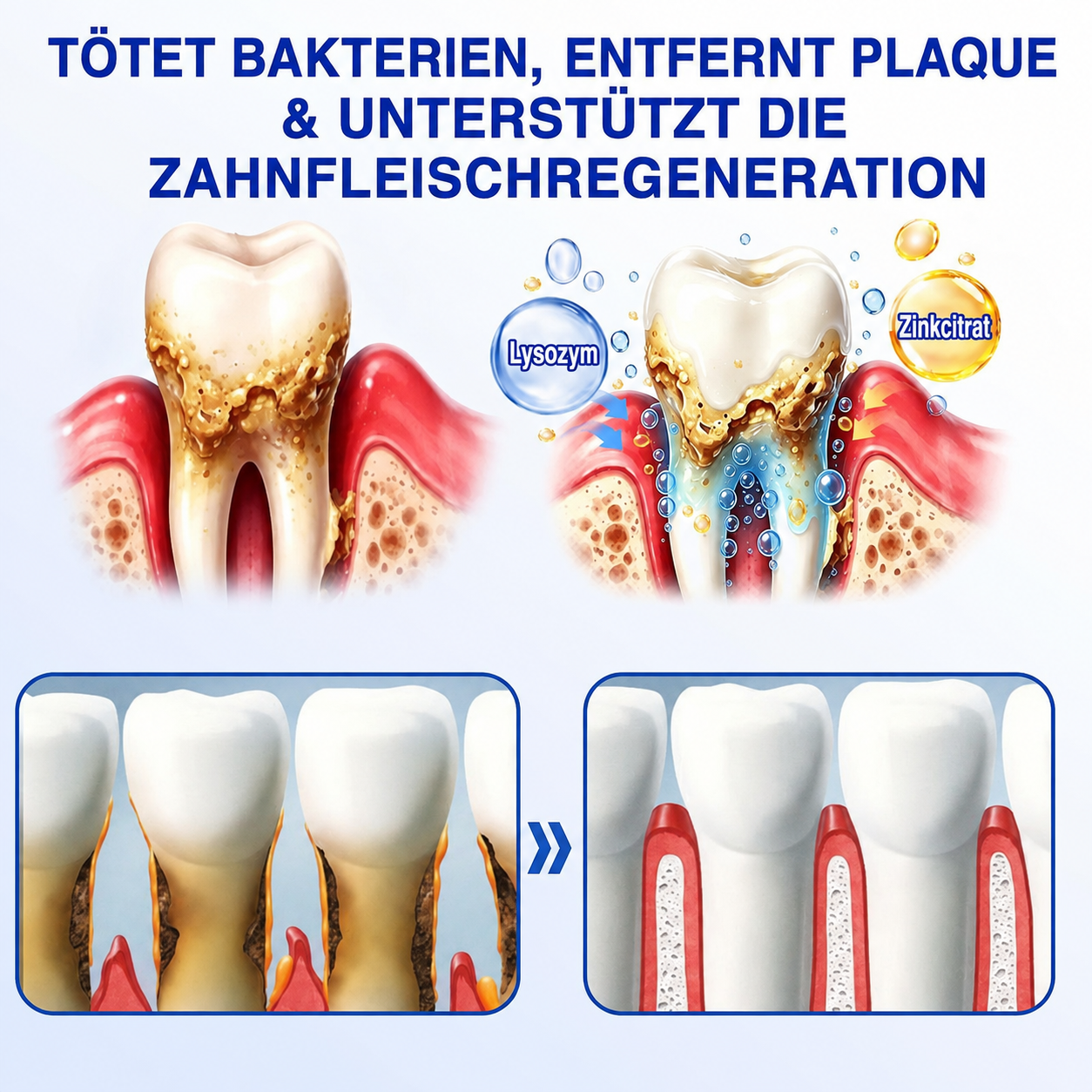 🦷 Healrize® GumRevive Gel zur Regeneration des Zahnhalteapparats (bei Zahnfleischbluten, Zahnfleischrückgang und lockeren Zähnen)