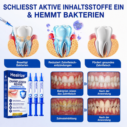 🦷 Healrize® GumRevive Gel zur Regeneration des Zahnhalteapparats (bei Zahnfleischbluten, Zahnfleischrückgang und lockeren Zähnen)
