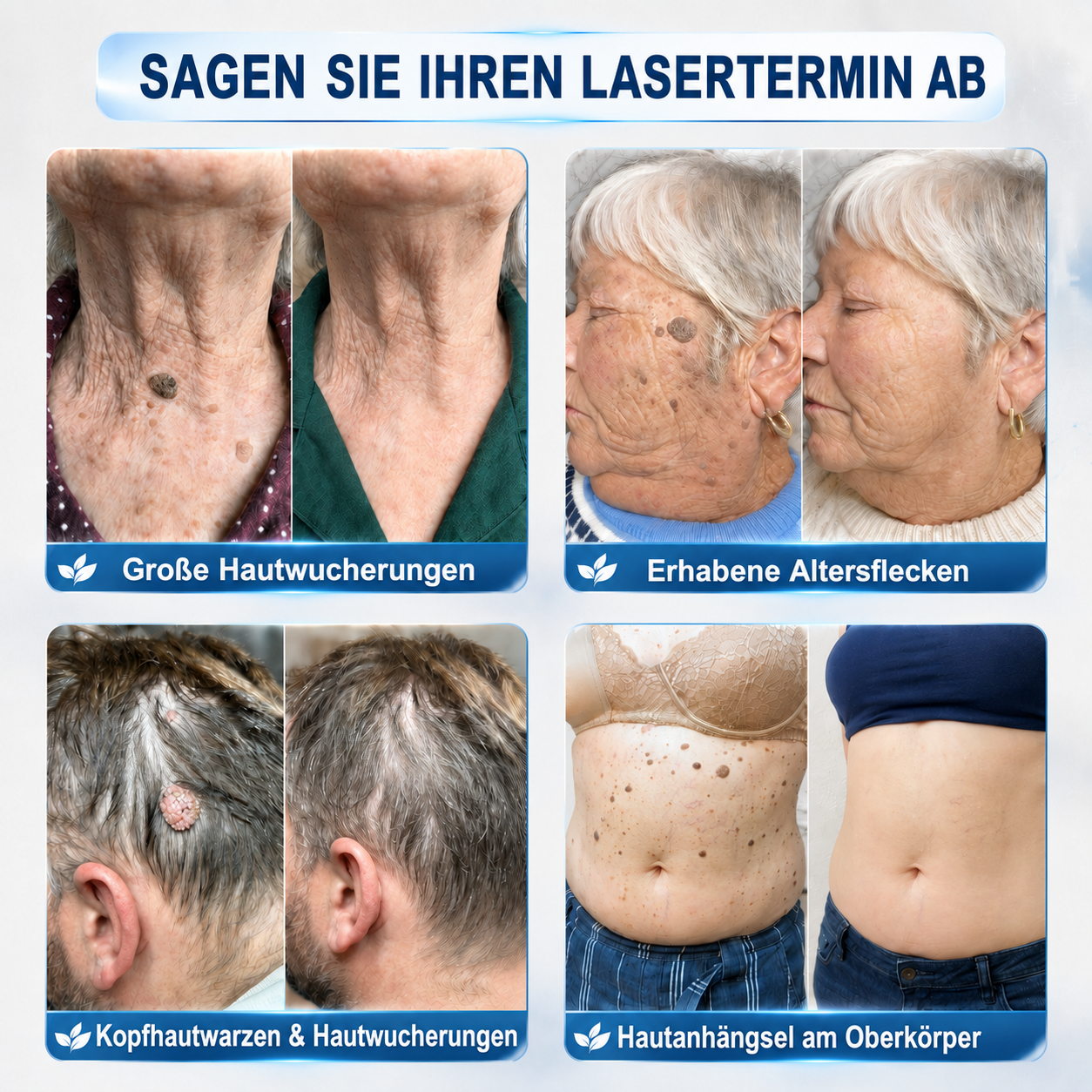 👑 30 % Rabatt auf den zweiten Artikel 🧡🧡 | Healrize®