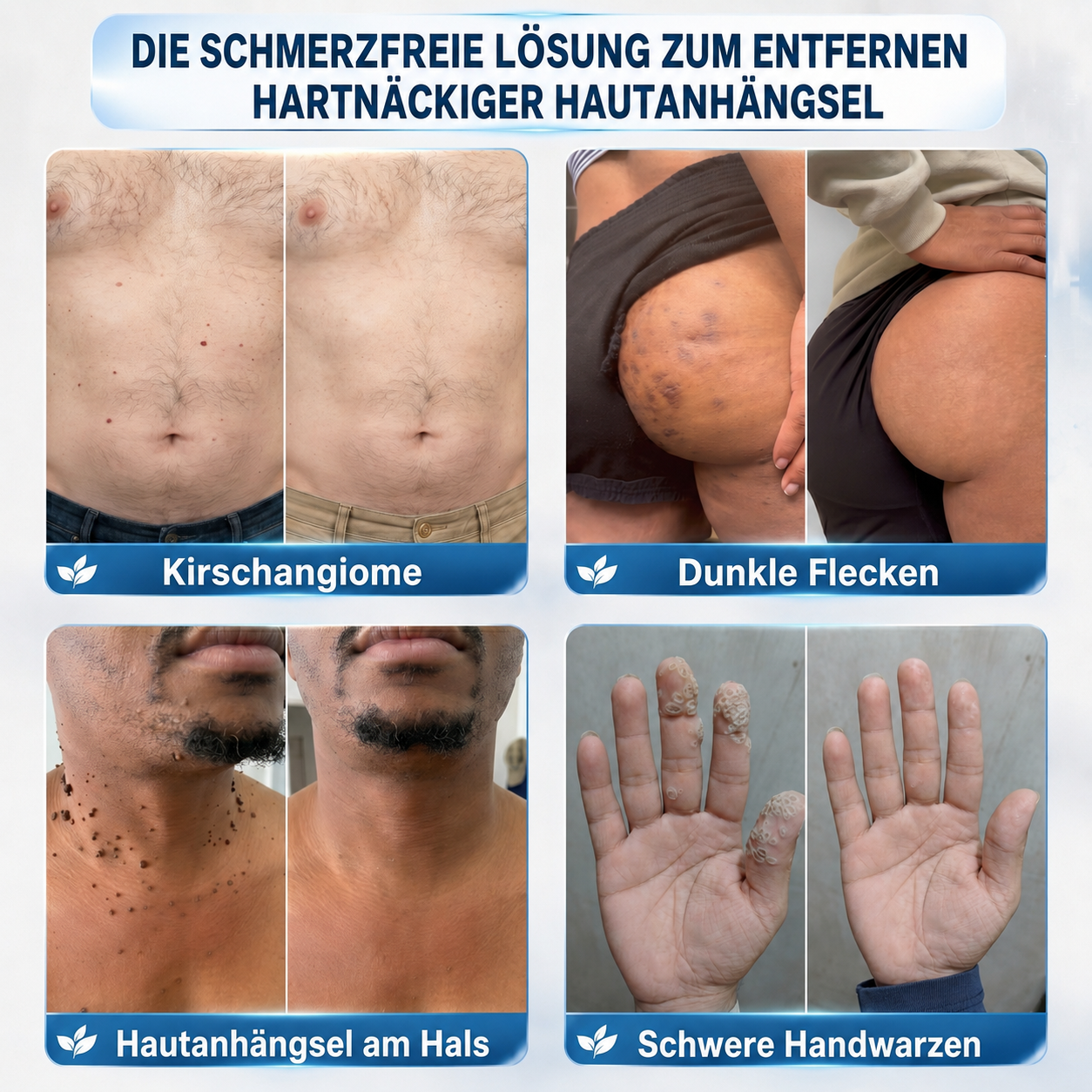 👑 30 % Rabatt auf den zweiten Artikel 🧡🧡 | Healrize®